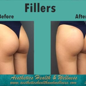 Butt fillers